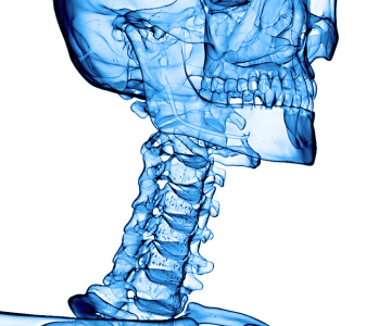 Krční páteř (Cervical spine)