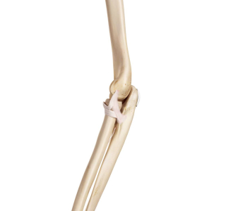 Loketní kloub  (Elbow joint)