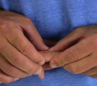 Interfalangeální klouby ruky