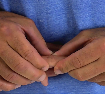 Interfalangové klouby ruky