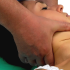 Atlantooccipitální skloubení (C0-1) – lateroflexe I (ATLANTOOCPITAL JOINT (C0-1) – LATEROFLEXION I)