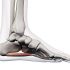 Flexory prstců a svaly chodidla (PLANTAR FLEXORS OF THE FINGERS AND MUSCLES OF THE PLANT)